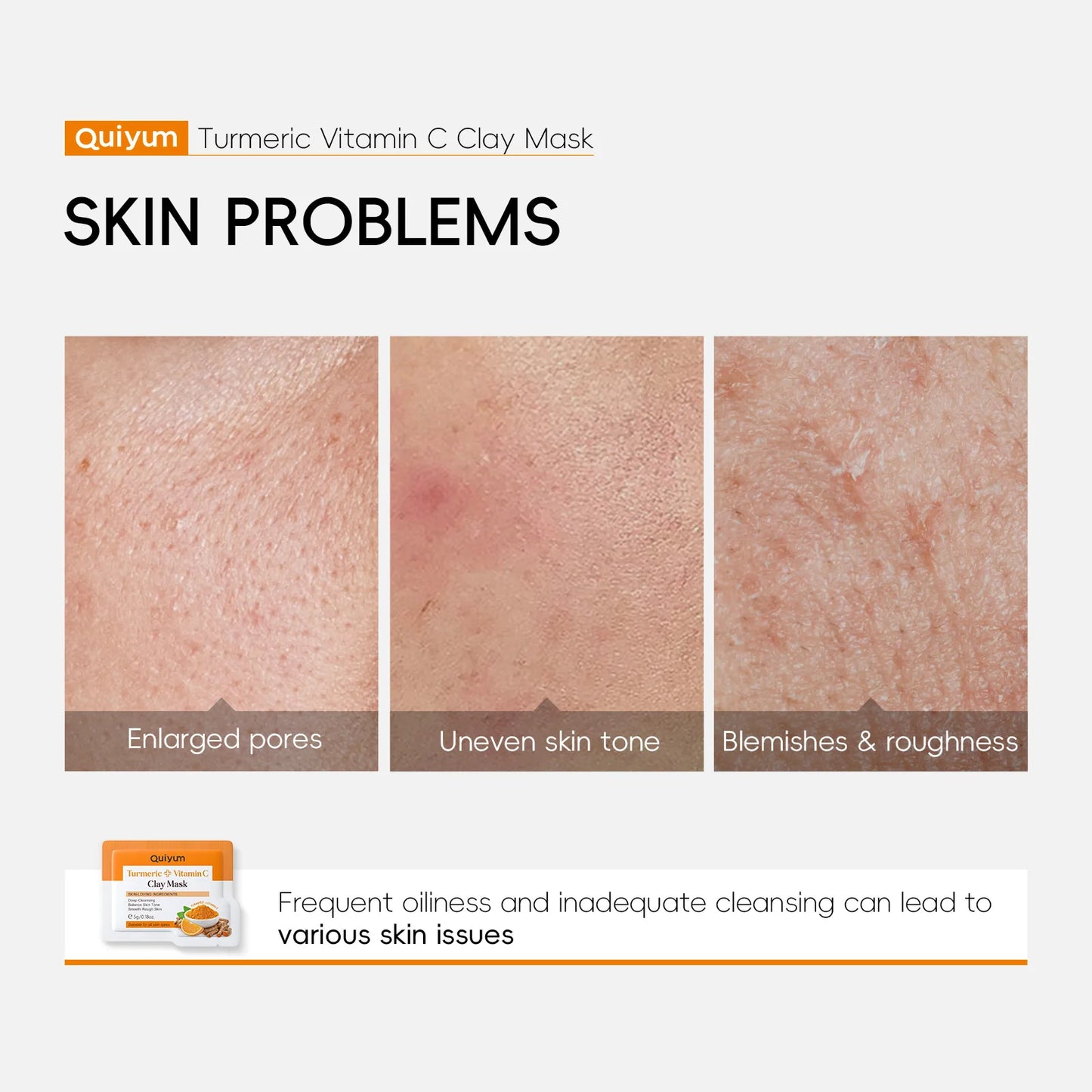Vitamin C Turmeric Face Masks